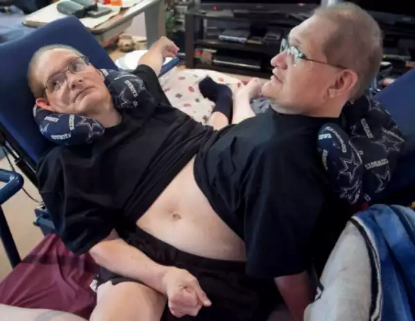 Video: World’s Oldest Living Conjoined Twins At 66