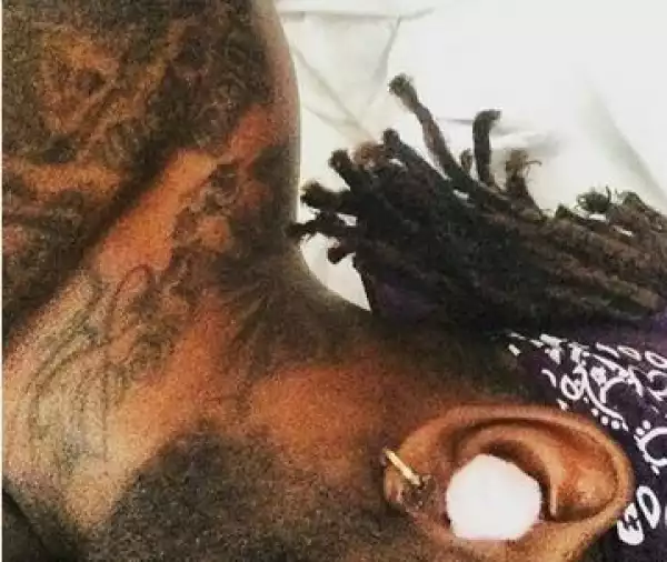 Burna Boy Suffering From Temporary Deafness? (See Photo)