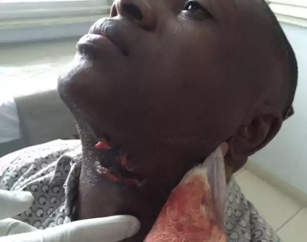Close-up pic of stab wound sustained by Channels TV reporter