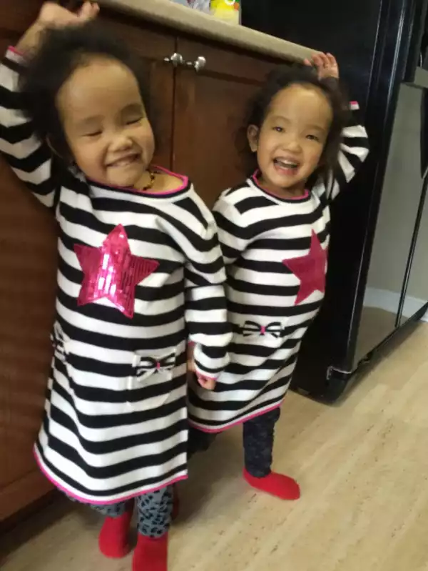 Father Told He Can Only Save One Of His Dying Twin Daughters