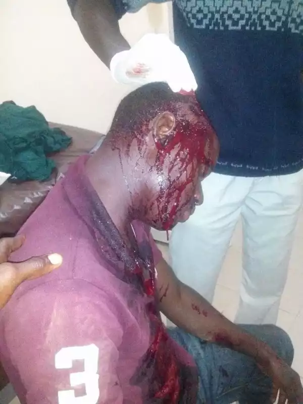 Graphic Photo: Man Withdraw 100,000 From ATM, Military Men Collected The Cash & Beat Him Up In Jos