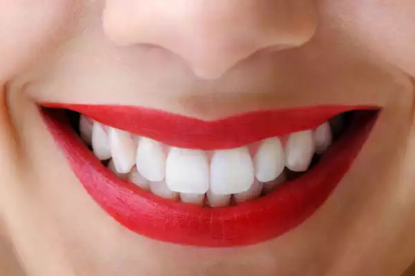 How (Steps) To Naturally Have Whiten Teeth