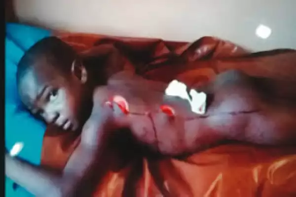 My Mum Said ‘I Will Kill You, I Will Kill You’– 6-Year-Old Boy Stabbed By His Wicked Mother