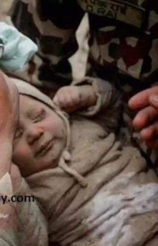 New Beautiful Photos Of 4-Month-Old Baby Rescued From Nepal