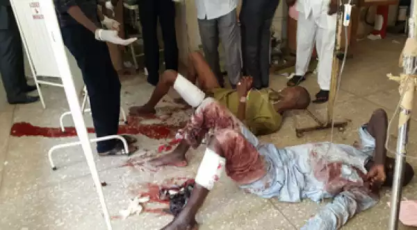 Photo: 10-Year-Old Female Suicide Bomber Attacks Yobe Market
