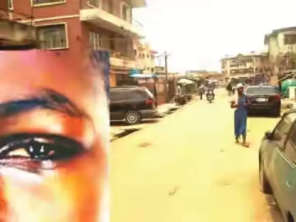 Photo: 15-Year-Old Boy Wents Partially Blind After Being Flogged By Step-Mother