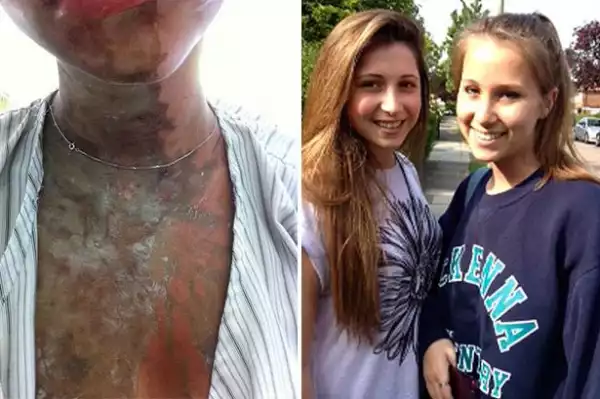 Photo: 2 Suspected Boko Haram Charged With Acid Attack On 2 British Teenagers