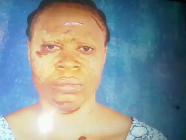 Photo: Man Batters Wife, Throws Her Out For Rejecting Custody Of Love Child 