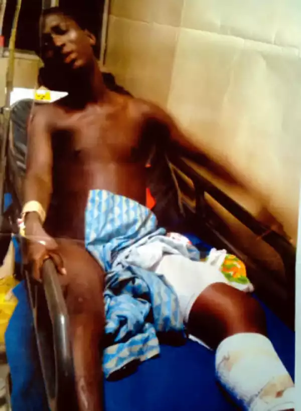 Photo: Secondary School Cultist Stabs Boy With Poisoned Knife, Victim’s Leg Amputated