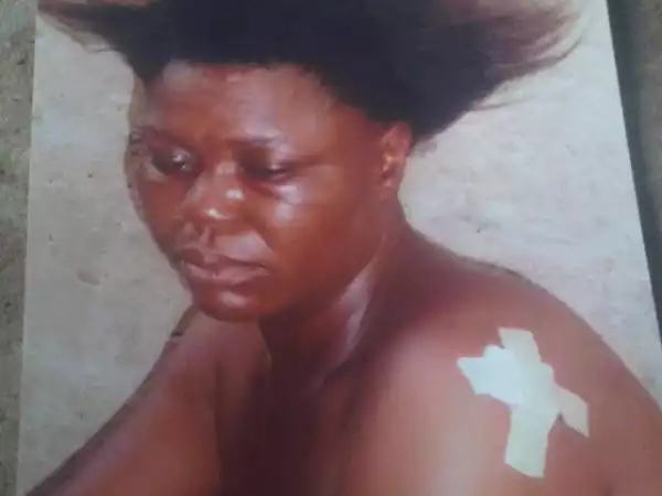 Photo: Woman Bites Off And Swallows Neighbour’s Tip In Lagos