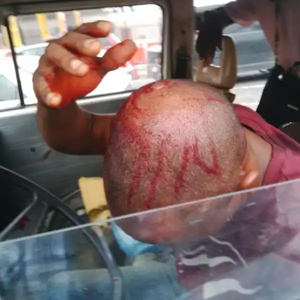 Photos: Policeman Injured Driver On The Head For Scratching A Car In Lagos 