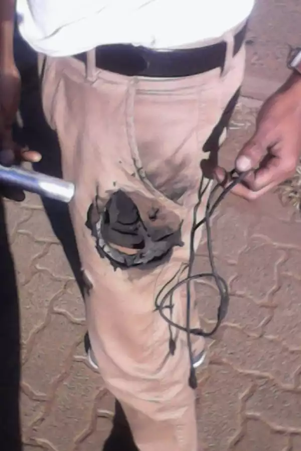 Photos: Power Bank Sets Owner On Fire