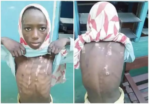 Photos:  Wicked Man Injures Wife, Beats Daughter With Barbed Wire In Lagos 