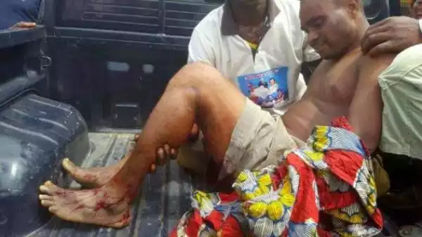 Photos Of People Attacked In Rivers State Today