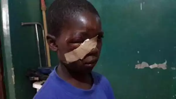 Photos Of Two Pupils Injured In The Jos School Building Collapse