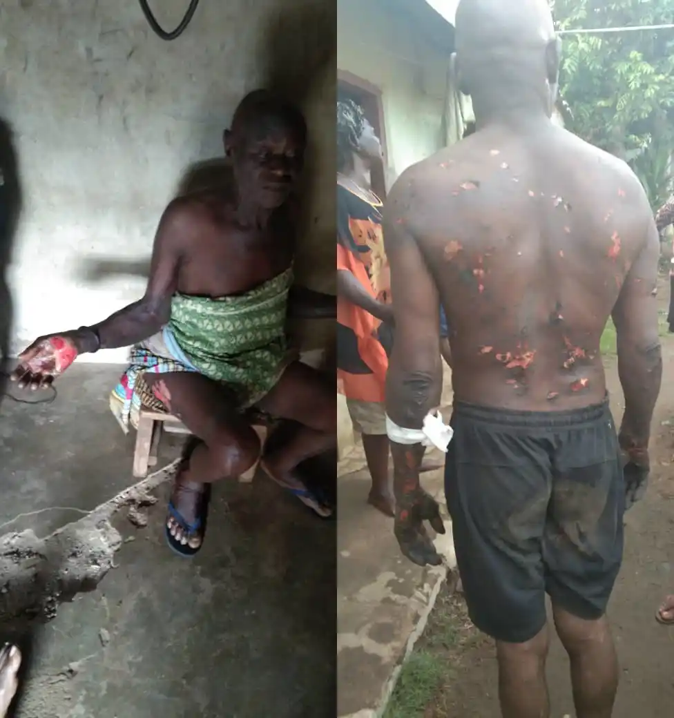 Special Adviser to the Cross River State Governor allegedly burns his subordinates after he had a dream that they betrayed him (photos)