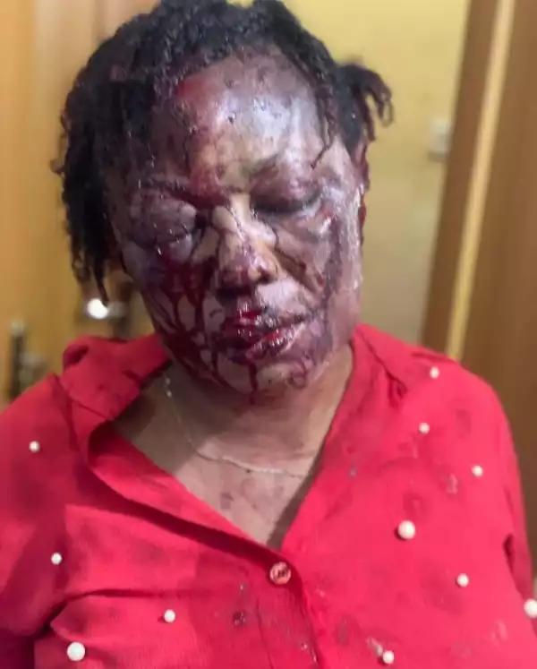 Woman Disfigured After Being Pummeled by Husband in Delta State (Photos)