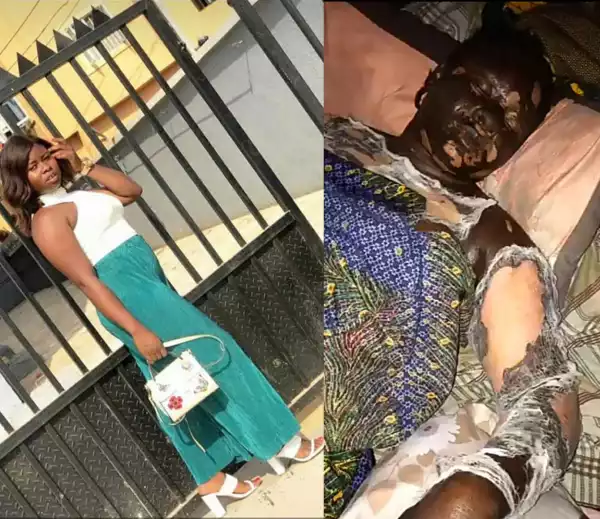 Friends mourn as woman dies after getting burnt while answering a phone call close to a gas cannister (graphic photos)