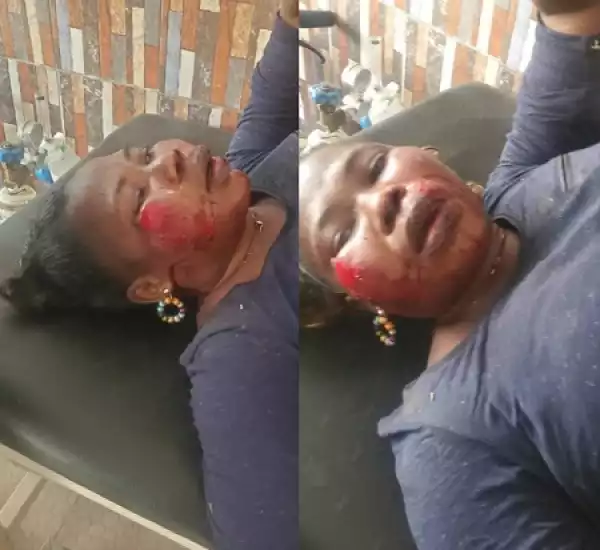 Woman Hospitalised After Being Brutalised by Ex-husband (Video)