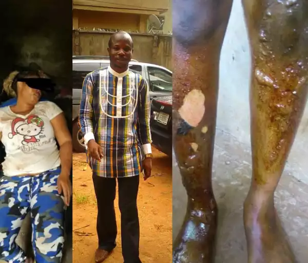 Man aledgedly brutalizes his wife by burning her skin after accusing her of gossiping (photos)