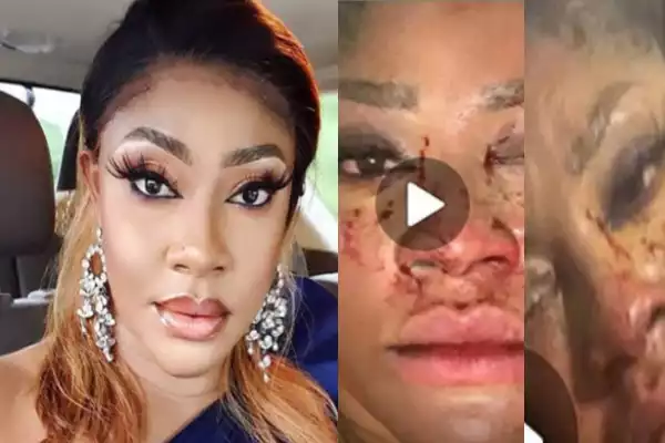 1 Year After 10 BULLETS Were Removed From Her Head After Assassins Attacked Her, See Recent Photos Of Actress Angela Okorie