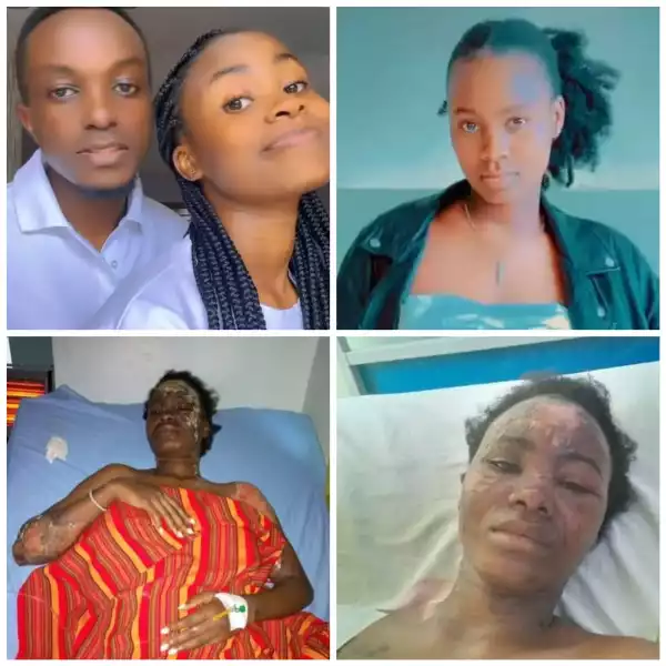20-year-old Woman Hospitalised After Boyfriend Poured Hot Water On Her (Photo)