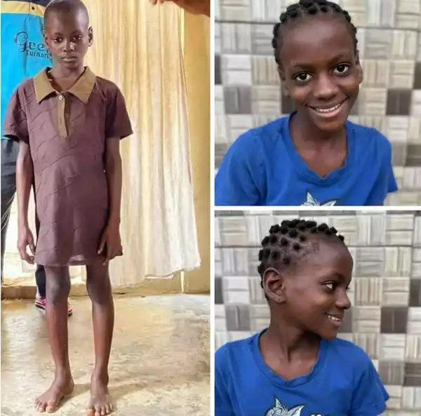 Young Girl Beaten And Abandoned After Being Accused Of Being A Witch In Akwa Ibom