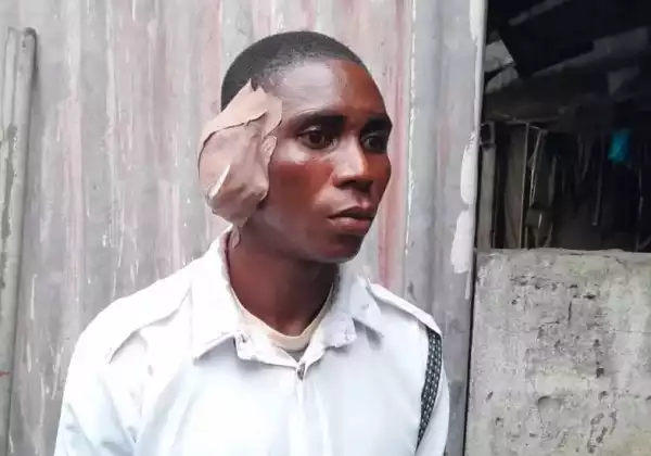 Drama As Driver Bites Off VIO officer’s Ear In Delta