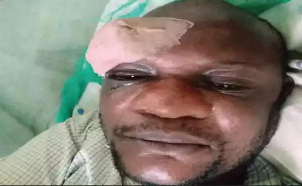 How Angry Customers Stabbed Ogun IBEDC Official In The Eye For Distributing Bills (Photo)