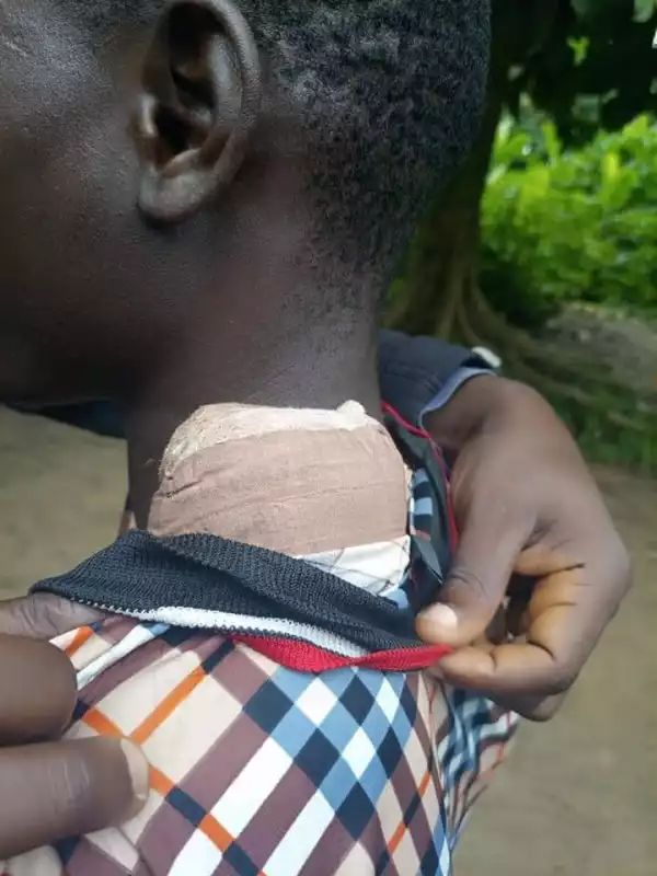 JSS 2 student stabs school prefect in Calabar after being told to take off wrong stockings