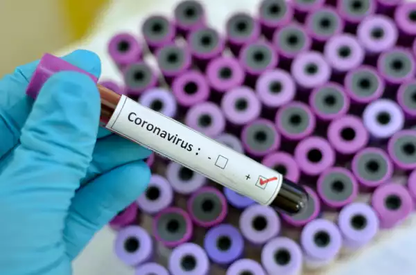 BREAKING: Third Coronavirus Case Confirmed In Lagos