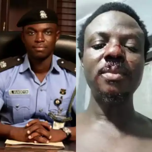 Man Abducted And Almost Killed After Boarding A Bus At Lekki-Ikoyi Roundabout Shares Experience, Police React (Video)