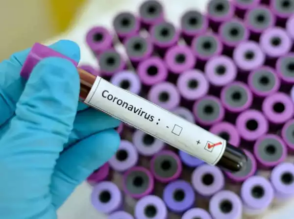 104 cases of Coronavirus confirmed in one company in Ogun state