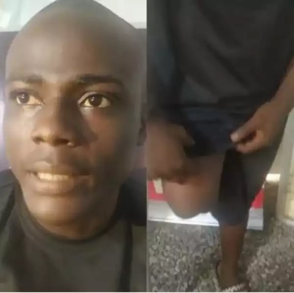 Lekki Tollgate Victim Narrates His Ordeal And How The Incident Left Him Disabled (Video)