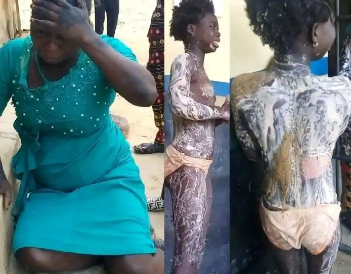 Aunt who poured hot water on her niece is finally arrested after absconding following the act