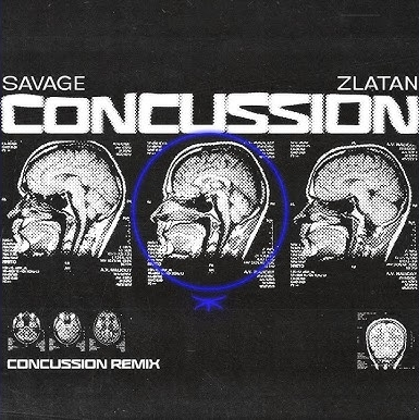 Savage Ft. Zlatan – Concussion (Remix)