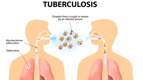 Novel collaboration inaugurated to transform treatment for tuberculosis