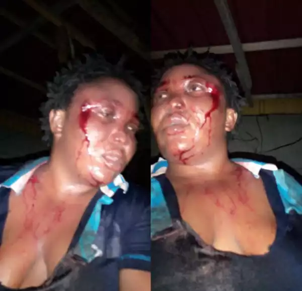 Man beats wife, posts the bleeding pictures on facebook and brags about it