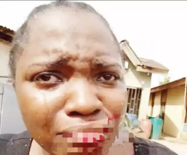 Photo Of Woman Who Was Brutalized For Refusing Man