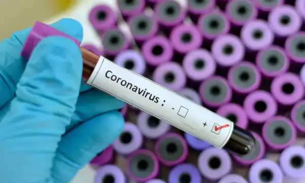 Confusion In Enugu As 72 Health Workers Test Positive For Coronavirus