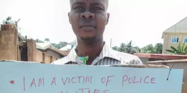 Man Narrates How He Was Abducted, Tortured, Imprisoned For ‘Exposing Corrupt Activities Of Nigerian Police Officers’