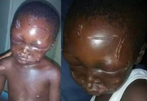 Disturbing photos of a 7-year-old boy who was gruesomely beaten by his stepfather 