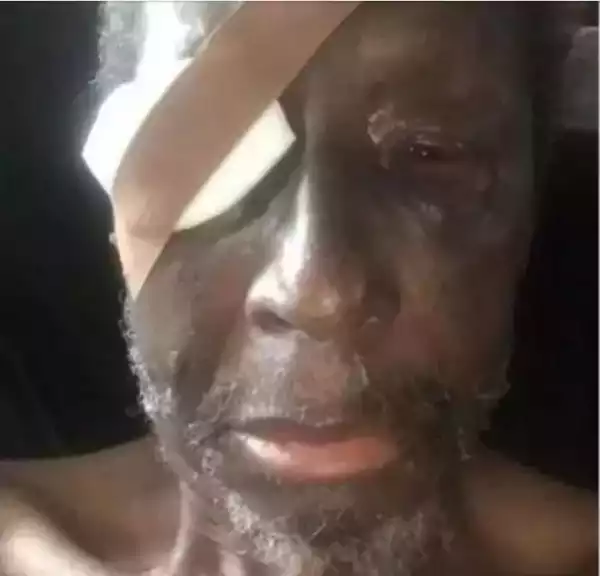 Ailing Veteran Nollywood Actor, Sadiq Daba Is Almost Losing An Eye - Journalist Claims