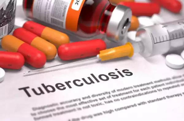 Drug resistance increasing tuberculosis in Delta – Experts