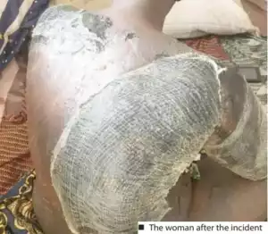 Woman Bathes Co-wife With Hot Water In Kaduna