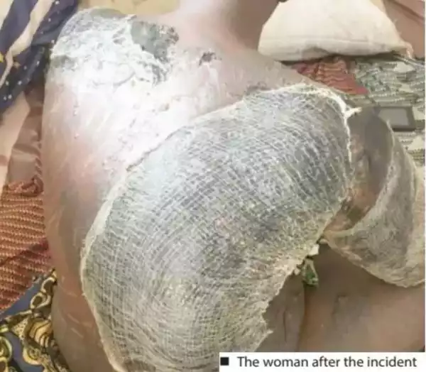 Woman Bathes Co-wife With Hot Water In Kaduna