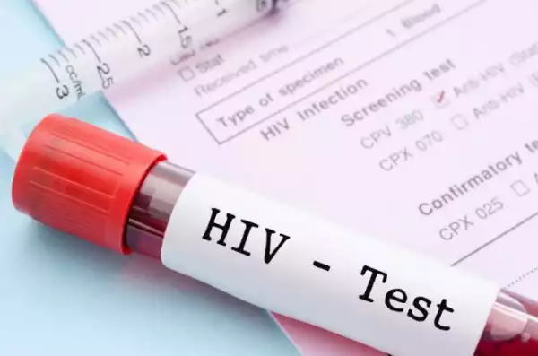 41% Of Nigerians Living With HIV — Report