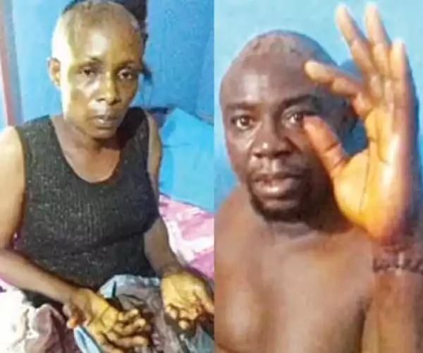 Landlord Allegedly Hacks Couple With Machete After The Woman 
