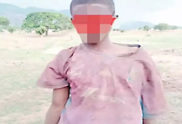 How A Farmer Attacked A Teenage Boy And Plucked Out His Two Eyes In Bauchi