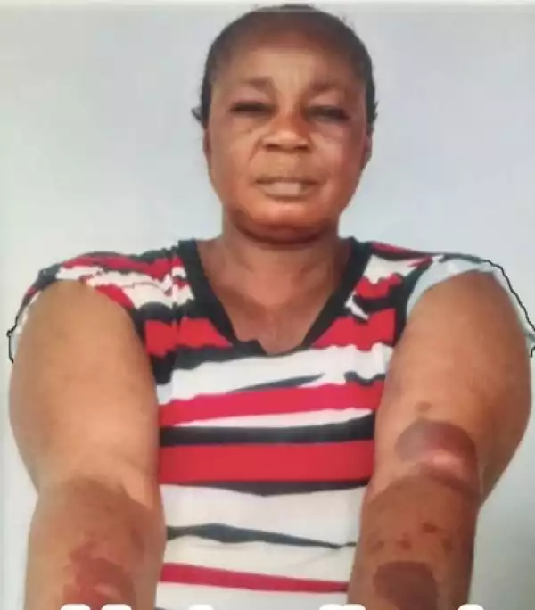 Story Of Woman Who Was Beaten To A Pulp By Landlord For Refusing His Love Advances (Photo)